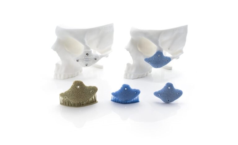 KLS Martin Set to Deliver 500th Lithoz-Printed Bioceramic Implant by End of 3Q 2026 KLS Martin now offers implants made from LithaBone TCP as an official product on their web-based IPS. Photo via KLS Martin.